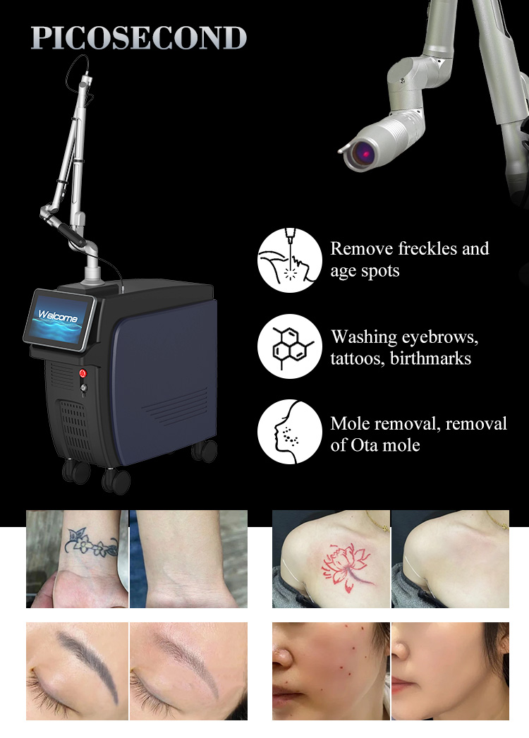 Nd Yag Laser Machine10